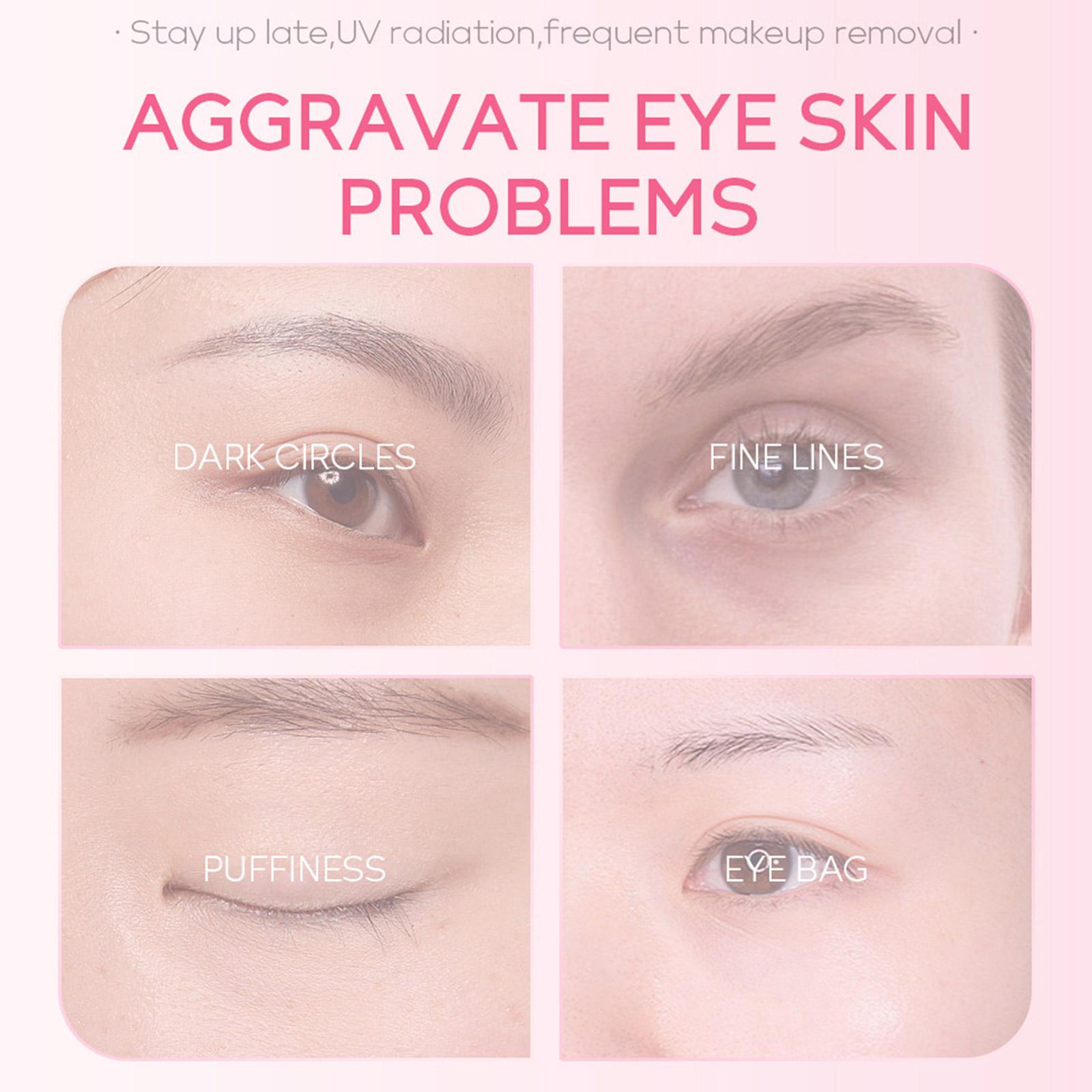 1/3/5pcs Sakura Eye Essence cr - Women Bags Under Eyes recensione e prezzo