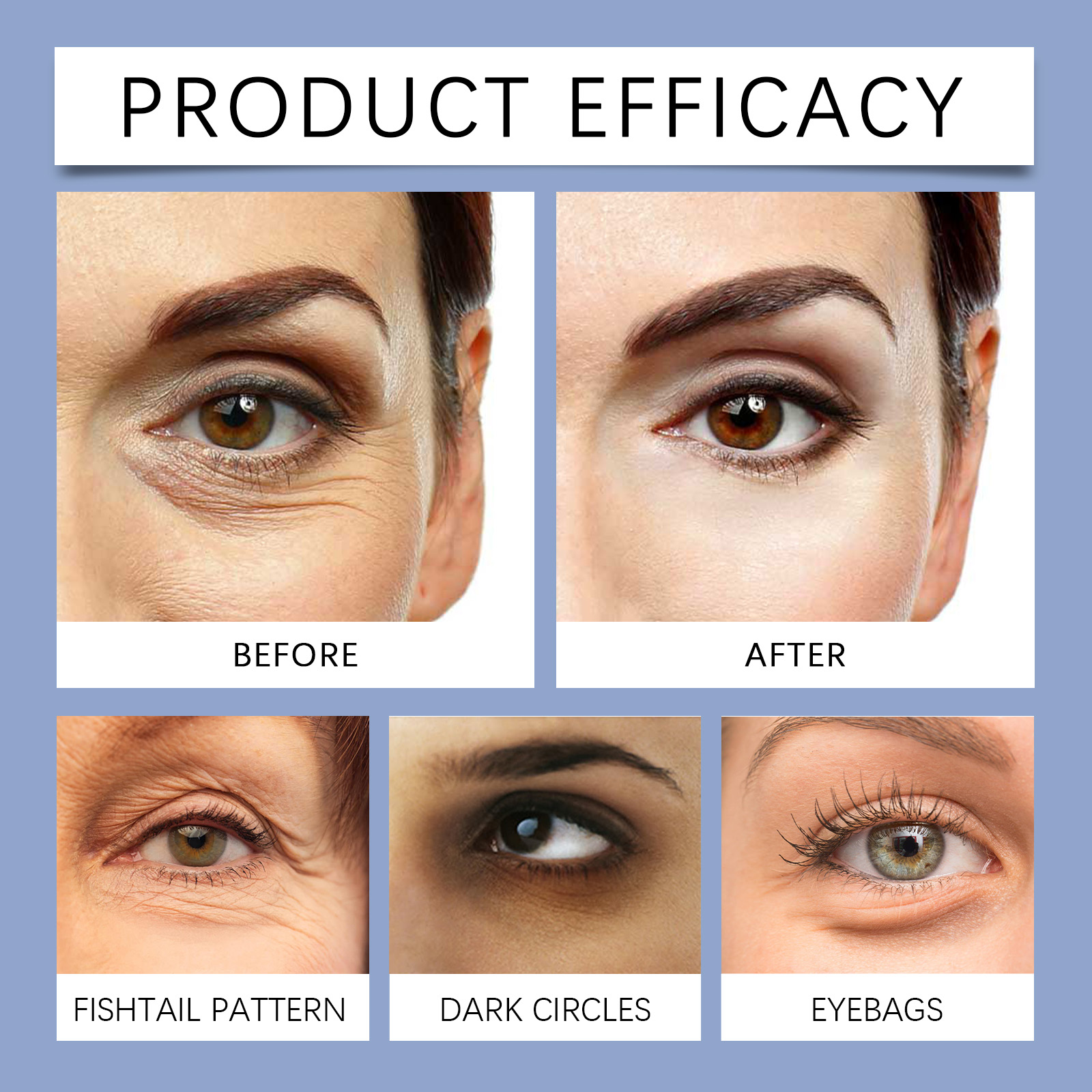 EELHOE Retinol Microneedle Eye - Women Bags Under Eyes recensione e prezzo