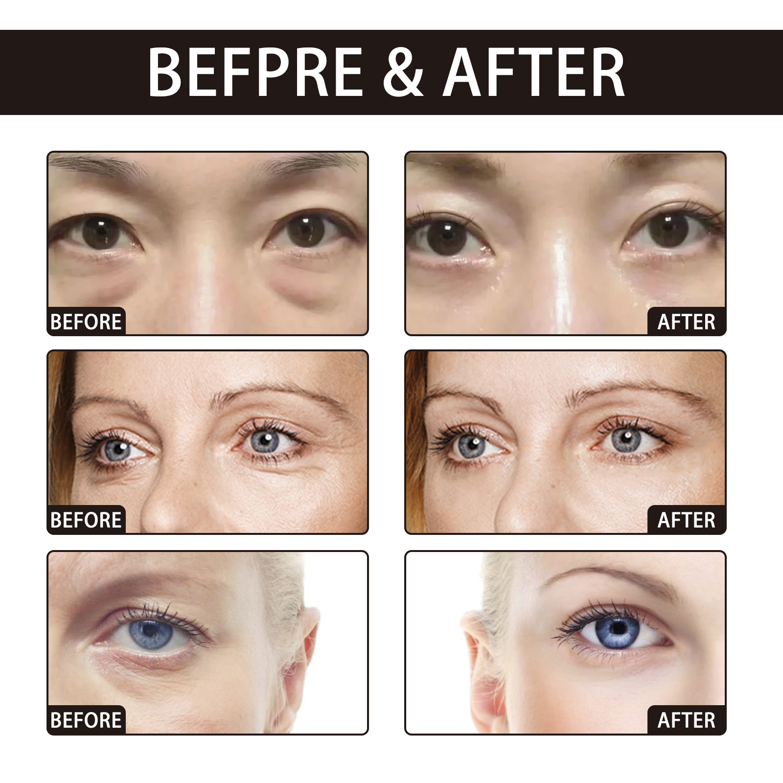 OUHOE Retinol Eye Cream Anti-W - Women Bags Under Eyes recensione e prezzo